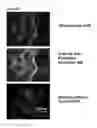 Fig. 78 - Microcarriers for Stem Cell Culture