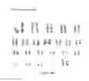 Fig. 96 - Microcarriers for Stem Cell Culture