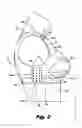 Fig. 03 - Multi-faceted brassiere assembly