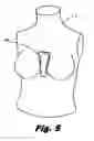 Fig. 06 - Multi-faceted brassiere assembly