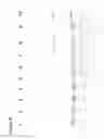 Fig. 07 - Oligonucleotide ligation methods for improving data quality and throughput using massively parallel sequencing