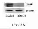 Fig. 03 - METHOD FOR DETERMINING A RISK, FOR A SUBJECT, OF SUFFERING FROM ATOPIC DERMATITIS OR SEVERITY OF ATOPIC DERMATITIS FOR A SUBJECT SUFFERING FROM ATOPIC DERMATITIS AND METHOD FOR USING A SINGLE-NUCLEOTIDE POLYMORPHISM RS12313273 AS A BIOMARKER FOR DETERMINING THE DEVELOPMENT OR SEVERITY OF ATOPIC DERMATITIS