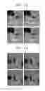 Fig. 10 - MICROFLUIDIC DEVICE FOR SIMULTANEOUSLY CONDUCTING MULTIPLE ANALYSES
