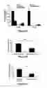 Fig. 07 - MiR-182-, miR-191, miR-199a-based methods for the diagnosis and prognosis of acute myeloid leukemia (AML)