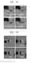 Fig. 10 - Microfluidic device for simultaneously conducting multiple analyses