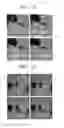 Fig. 10 - MICROFLUIDIC DEVICE FOR SIMULTANEOUSLY CONDUCTING MULTIPLE ANALYSES
