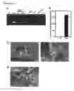 Fig. 05 - HIGHLY SENSITIVE DETECTION METHOD FOR HIGHLY VIRULENT ORAL CAVITY BACTERIA