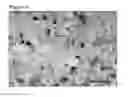 Fig. 06 - HIGHLY SENSITIVE DETECTION METHOD FOR HIGHLY VIRULENT ORAL CAVITY BACTERIA