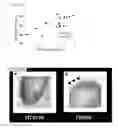 Fig. 12 - HIGHLY SENSITIVE DETECTION METHOD FOR HIGHLY VIRULENT ORAL CAVITY BACTERIA