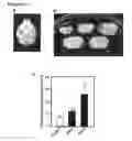 Fig. 14 - HIGHLY SENSITIVE DETECTION METHOD FOR HIGHLY VIRULENT ORAL CAVITY BACTERIA
