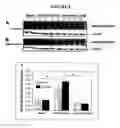 Fig. 07 - Methods, systems, and compositions for calpain inhabition