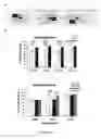 Fig. 02 - Use of rasagiline for the treatment of olfactory dysfunction