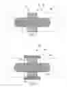 Fig. 02 - Fracture fixation systems