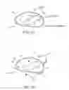 Fig. 03 - Systems and methods for delivery of a therapeutic agent