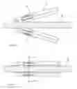 Fig. 06 - Simplified handgrip for assessment of colonoscope manipulation