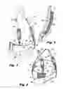 Fig. 02 - Pannus support adapted for surgical procedures