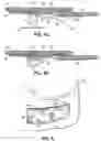 Fig. 06 - Restraint device and method of use