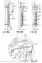 Fig. 09 - Restraint device and method of use