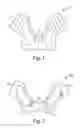 Fig. 02 - Ankle brace