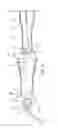 Fig. 06 - System and method for pain reduction during skin puncture and breakable tip therefor