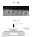 Fig. 09 - Applicator for microneedle array