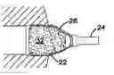 Fig. 01 - MALE EXTERNAL URINARY INCONTINENCE DEVICE