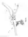 Fig. 12 - Tools and methods related to catheter delivery