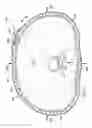 Fig. 06 - Reduced-pressure, compression systems and apparatuses for use on a curved body part