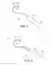 Fig. 03 - Adjustable device for delivering implants and methods of delivering implants