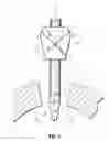 Fig. 02 - Wound closure device including mesh barrier