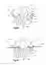 Fig. 09 - Orthognathic implant and methods of use