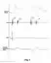 Fig. 02 - Pulse detection apparatus, software, and methods using patient physiological signals