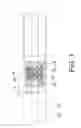 Fig. 02 - Endoprosthesis holder