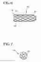 Fig. 09 - Stent-graft with bioabsorbable structural support