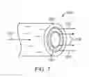 Fig. 06 - BIOABSORBABLE STENT WTIH LAYERS HAVING DIFFERENT DEGRADATION RATES