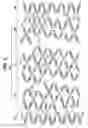 Fig. 06 - Flexible stent having protruding hinges
