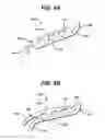 Fig. 07 - Flexible stent having protruding hinges