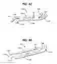 Fig. 08 - Flexible stent having protruding hinges