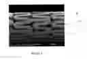 Fig. 08 - DRUG DELIVERY ENDOVASCULAR STENT AND METHOD OF USE