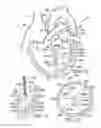 Fig. 09 - Method of reshaping a ventricle