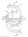 Fig. 01 - Ophthalmic lens with optical sectors