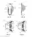 Fig. 02 - Method and apparatus for anchoring an intraocular lens assembly