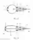 Fig. 06 - Support structure implant for a bone cavity