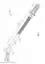 Fig. 02 - Implant assembly having an angled head