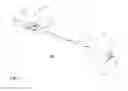 Fig. 08 - System and methods for spinal fusion
