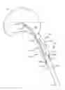 Fig. 01 - Spine surgery method and instrumentation
