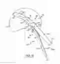 Fig. 05 - Spine surgery method and instrumentation