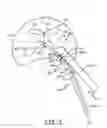 Fig. 06 - Spine surgery method and instrumentation