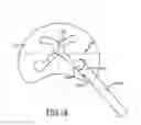 Fig. 07 - Spine surgery method and instrumentation