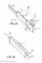 Fig. 15 - Spine surgery method and instrumentation